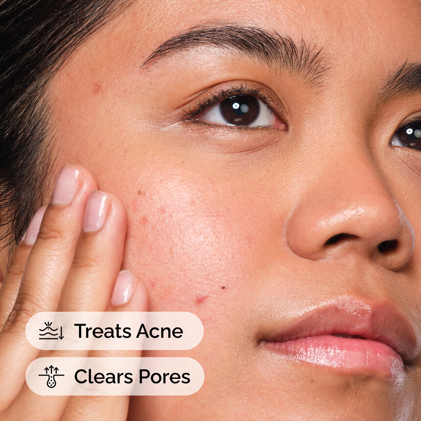 Acne & blemish Care