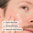 Mandelic Acid 10% + HA Gentle Facial Exfoliating Serum for Hydration