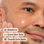 Alpha Arbutin 2% + Hyaluronic Acid for Hyperpigmentation