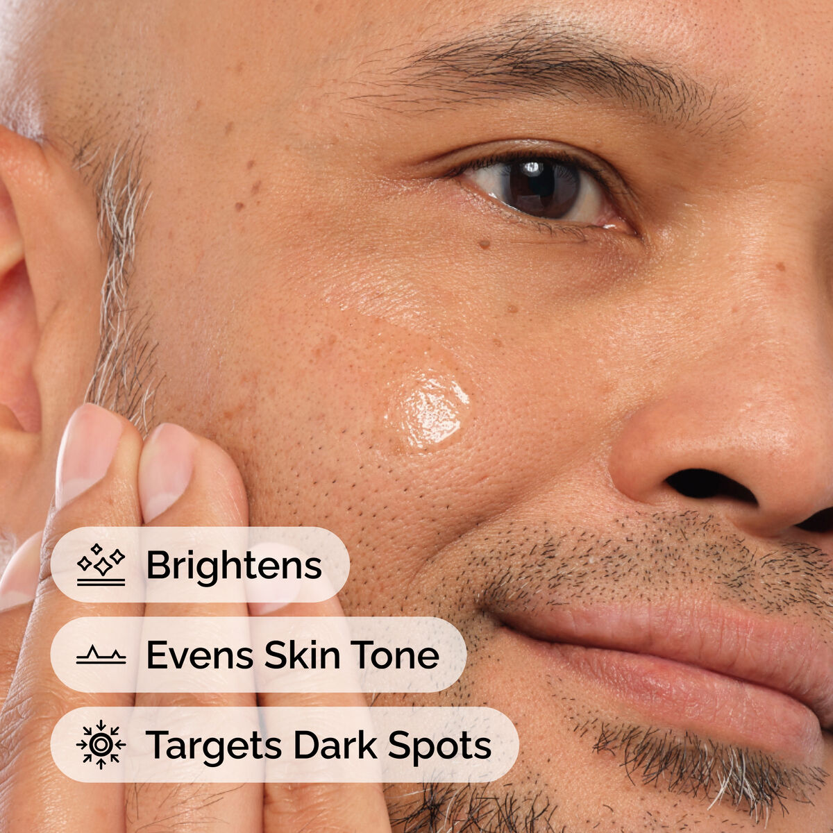 Alpha Arbutin 2% + Hyaluronic Acid for Hyperpigmentation